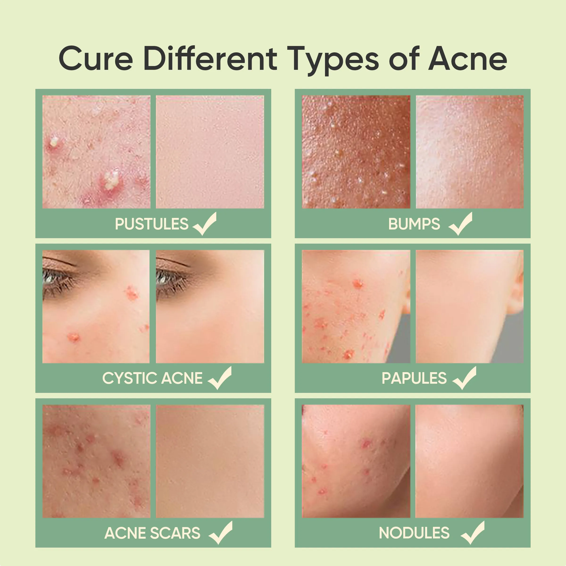SKINTIFIC Salicylic Acid Acne Spot Treatment (10g)