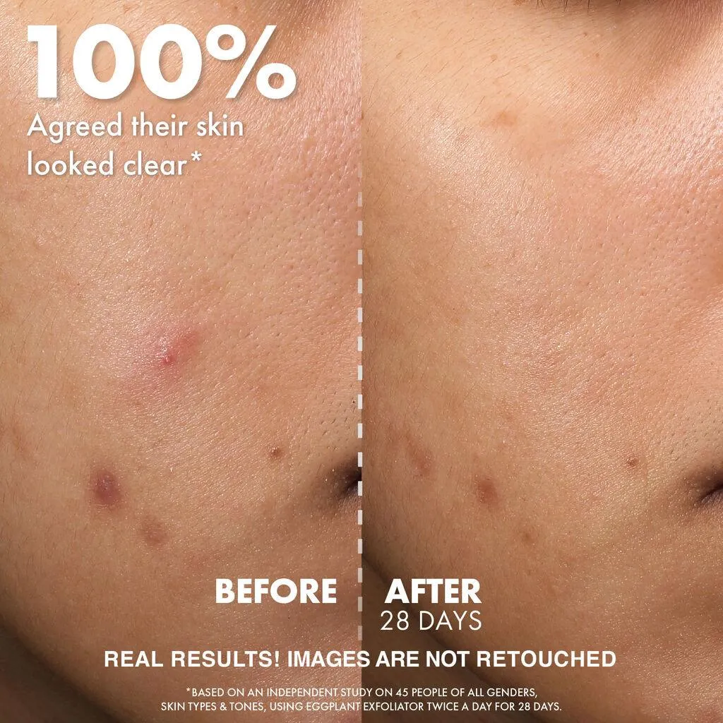 Wishful Eggplant Exfoliator: 9.5% Aha, Bha & Pha Pore Clarifying Daily Toner